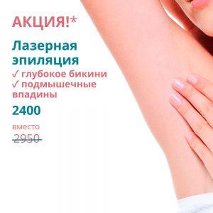 Лазерная эпиляция