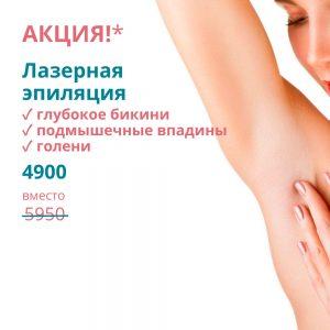Лазерная эпиляция