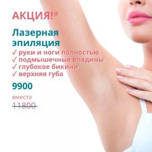 Лазерная эпиляция